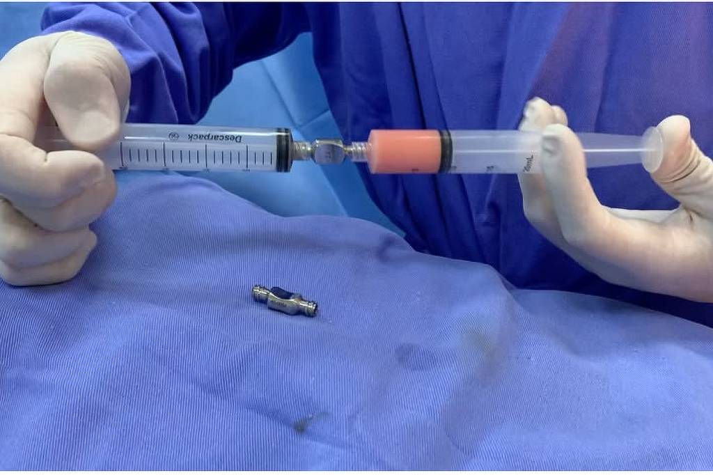 Mãos com luvas seguram duas seringas conectadas sobre tecido azul