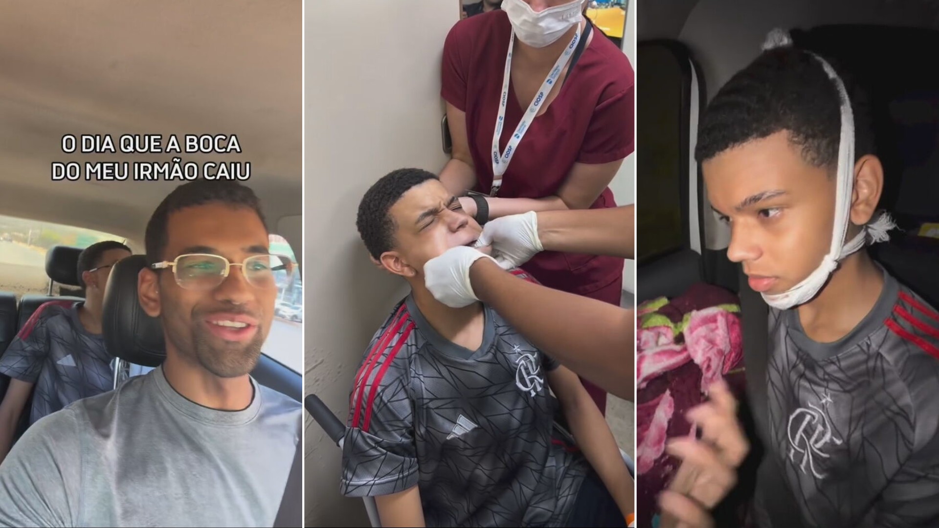 Adolescente Felipe Santos Firmino com a boca aberta após mandíbula travar