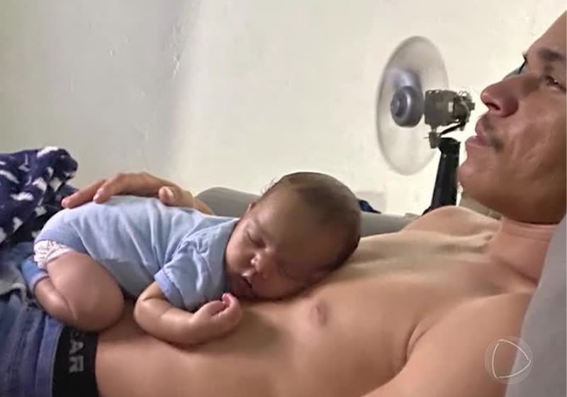 Bebê Isaac durante recuperação após transplante de fígado