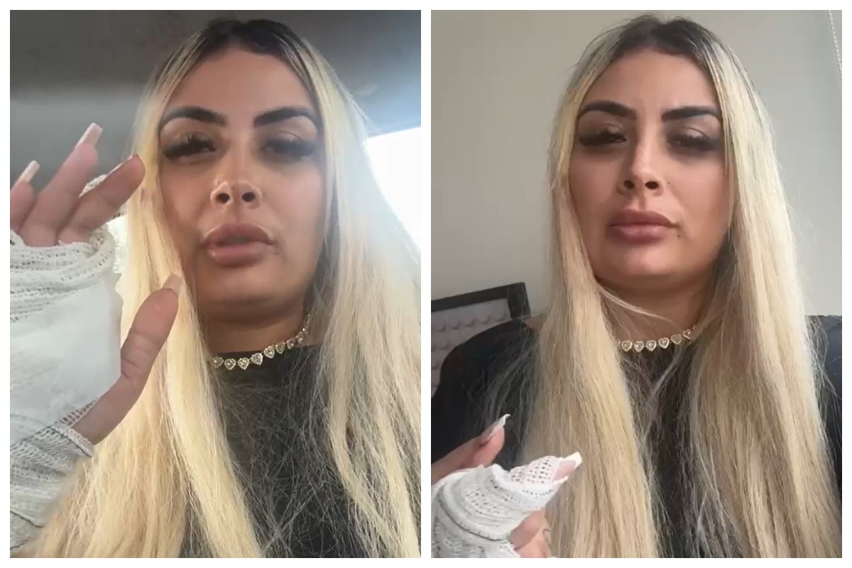 Mulher com cortes nas mãos após agressão