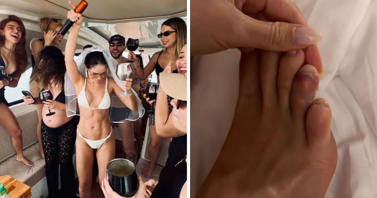 Juliette Freire mostra dedo inchado após despedida de solteira