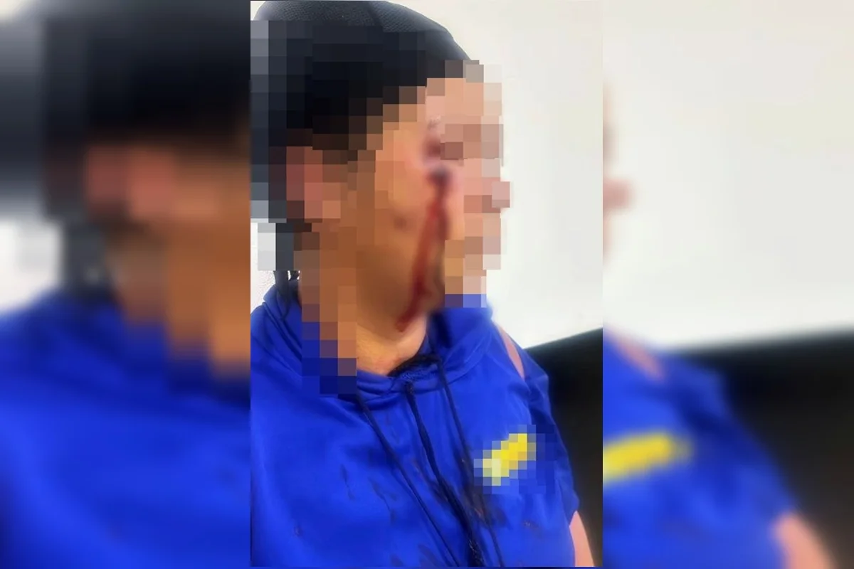 Mulher com ferimentos no rosto após agressão em Cristalina