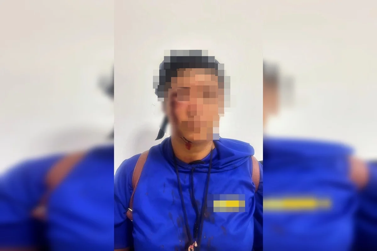 Mulher com ferimentos no rosto após agressão em Cristalina