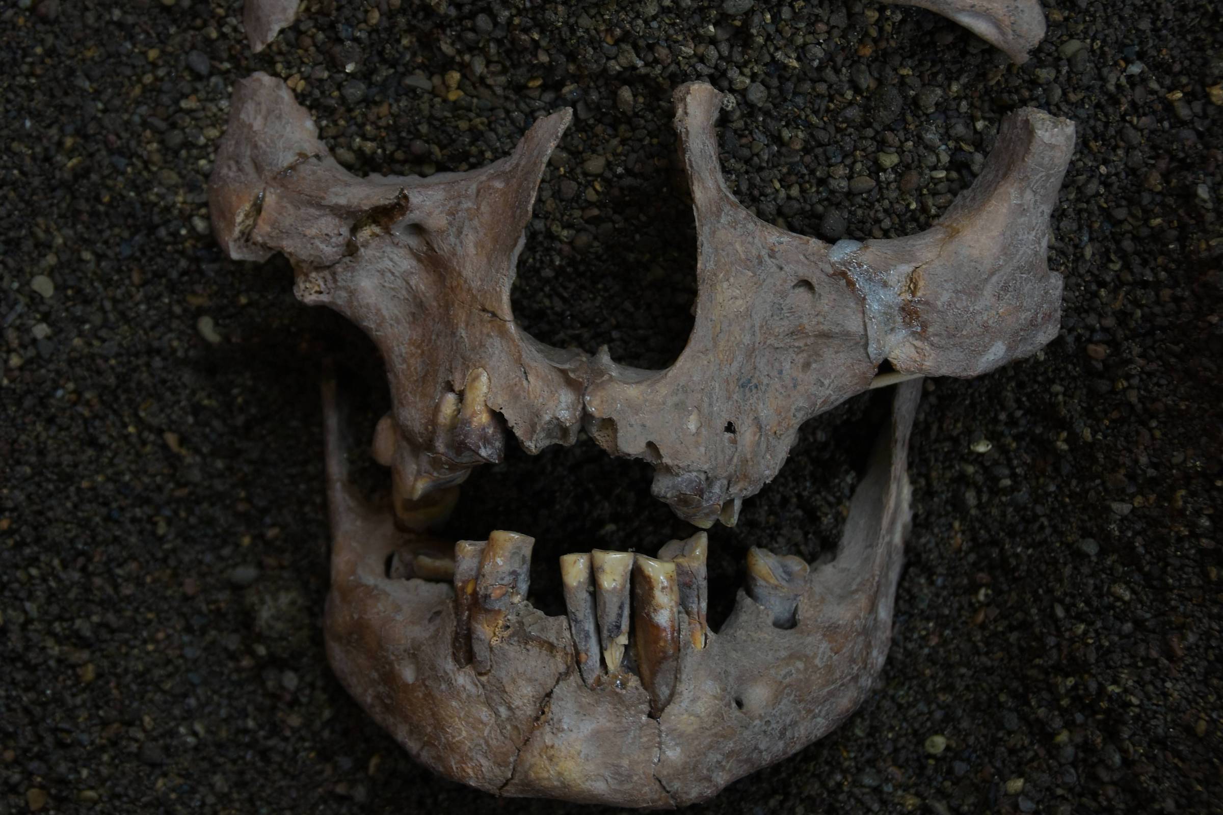 Fragmentos de crânio e mandíbula de humano antigo com dentes preservados