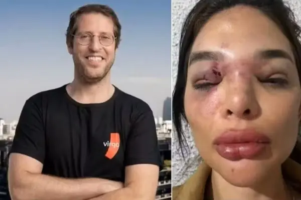 Empresário que agrediu esposa dentista é acusado de tortura após deixar a prisão