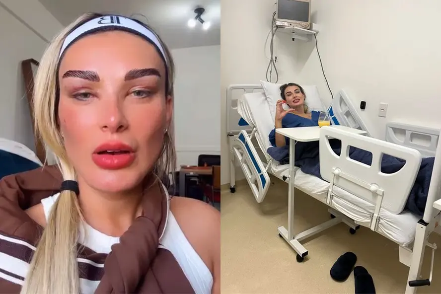 Andressa Urach após transplante de sobrancelhas