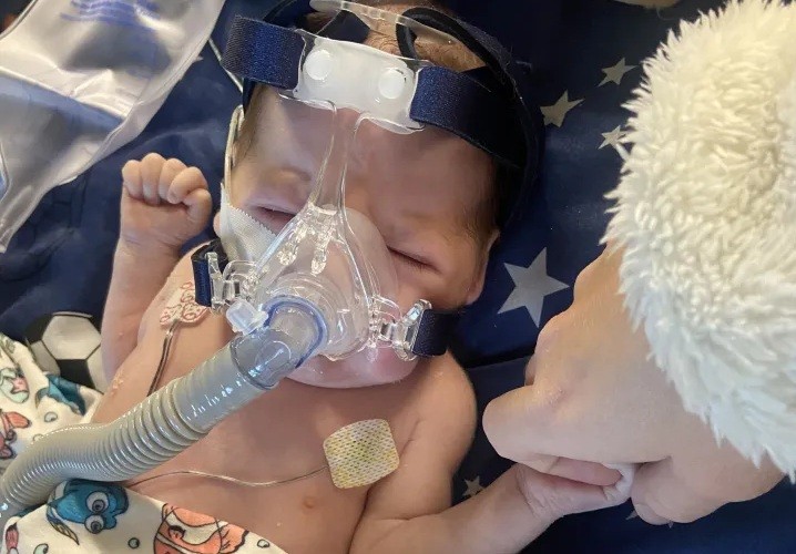 Bebê internado usa máscara de oxigênio e recebe cuidados médicos