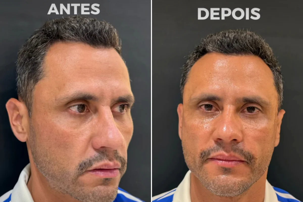 Cleitinho Azevedo durante atendimento estético