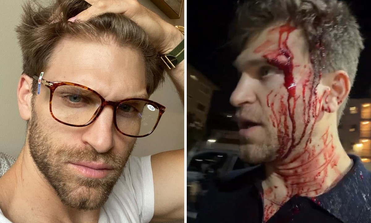 Keegan Allen, ator de Pretty Little Liars