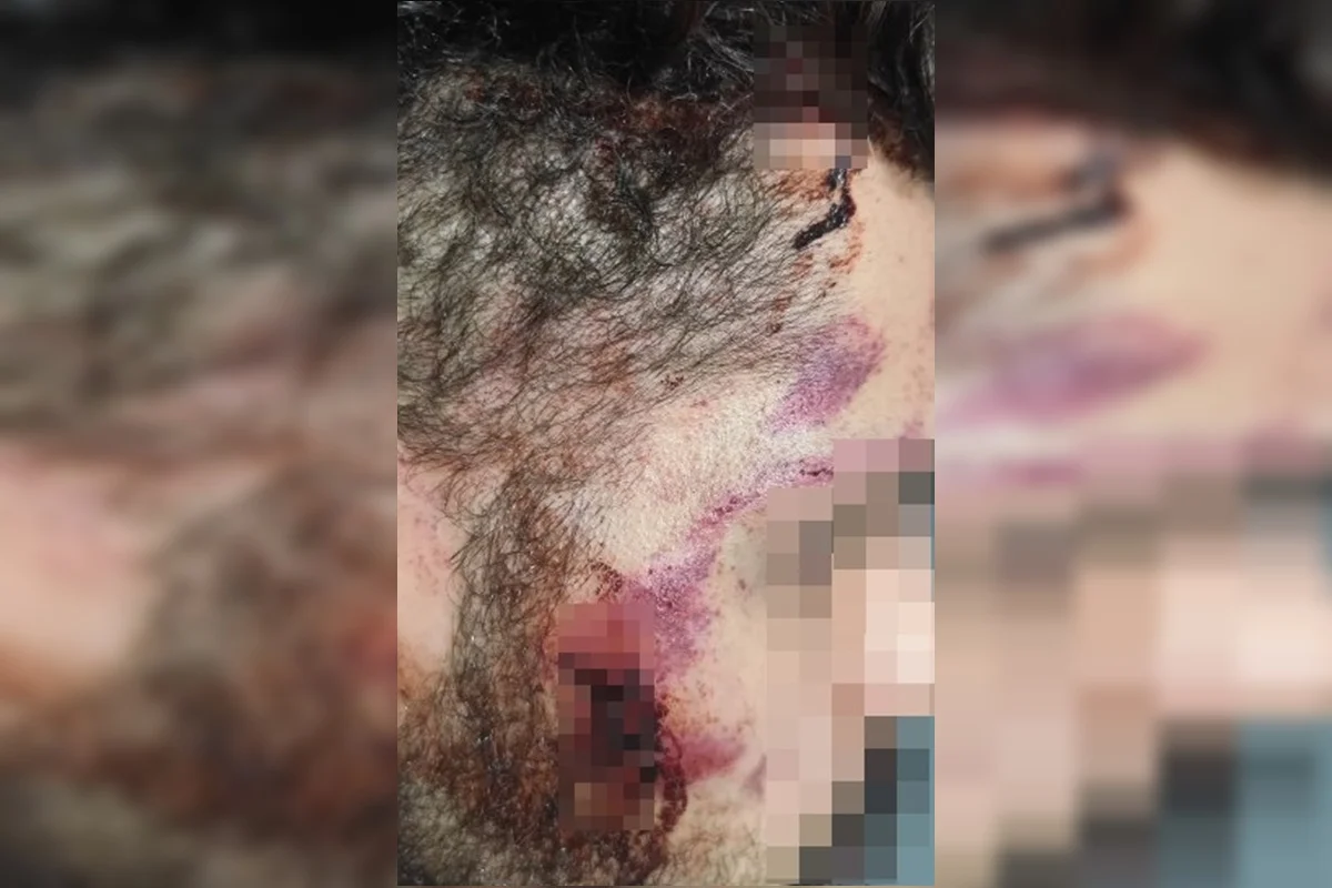 Motorista de aplicativo caído em calçada durante agressão no Guará