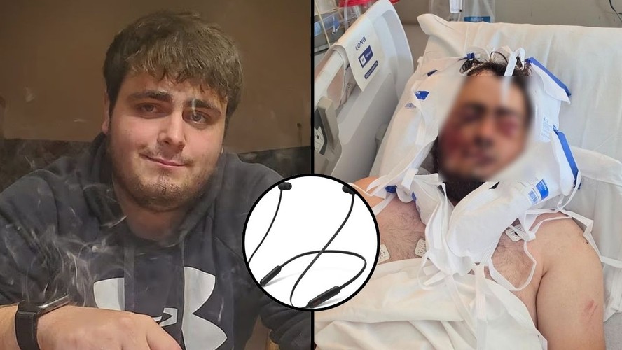 Joseph Little após sofrer acidente durante pescaria no Oregon